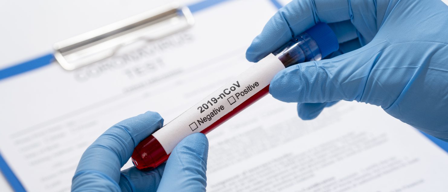 Covid-19の流行におけるベトナムでの従業員向けの体制-03